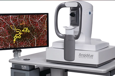 Fibre à lentille en tomographie par cohérence optique